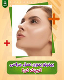 ژل کوچک کننده بینی